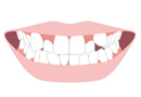 前歯の形が気になる、奥歯の生え方が気になる