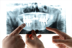 対症療法よりも、全体治療